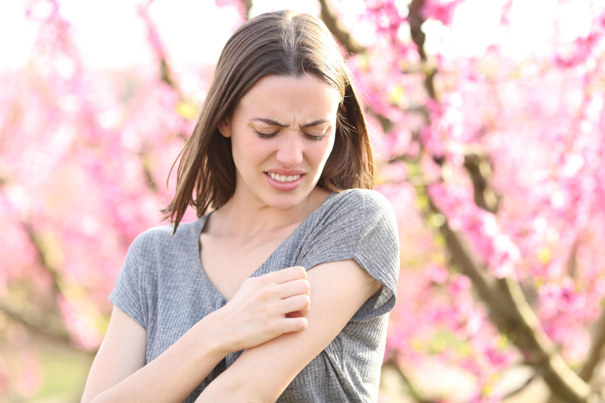 20 % des allergiques au pollen présentent de l’eczéma ou de l’urticaire.