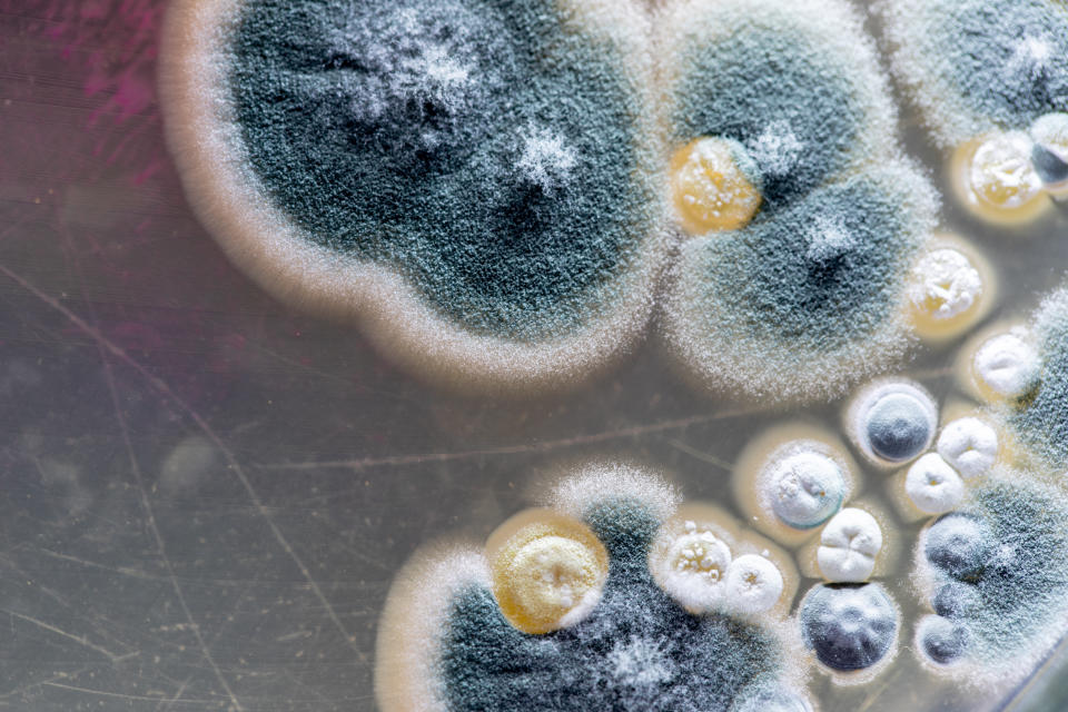 Mould exposure can be potentially dangerous to your health, depending on the quantity and exposure level (Photo via Getty).