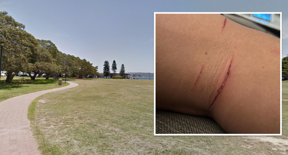 The injuries a Sydney woman sustained overlayed with an image of Rose Bay.