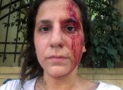 TV producer Yara Abi Nader is pictured with her face covered in blood, in a selfie following a blast in Beirut's port area
