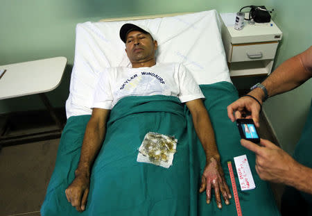 A nurse takes a photograph of a patient's burnt skin who is undergoing a treatment with tilapia fish skin at Dr. Jose Frota Institute in the northeastern costal city of Fortaleza, Brazil, April 17, 2017. REUTERS/Paulo Whitaker