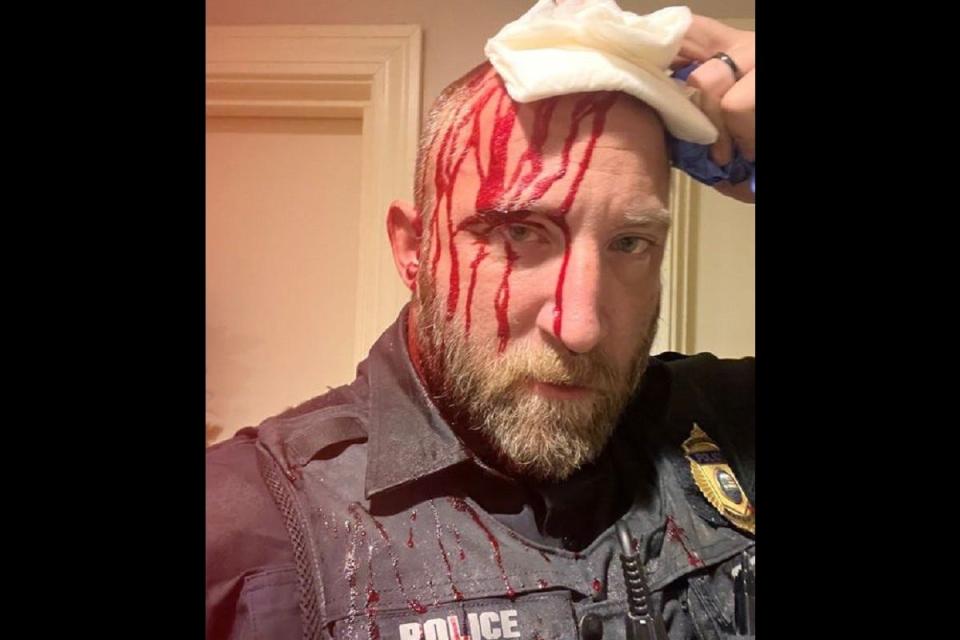 Marshfield police Sgt. Liam Rooney suffered a head injury when reportedly struck with a porcelain statue during a mental health check on Feb. 19.