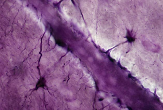 Astrocytes; neuroglial cells, 250X at 35mm. Shows: processes (perivascular feet) of neuroglial cells in contact with a brain cap