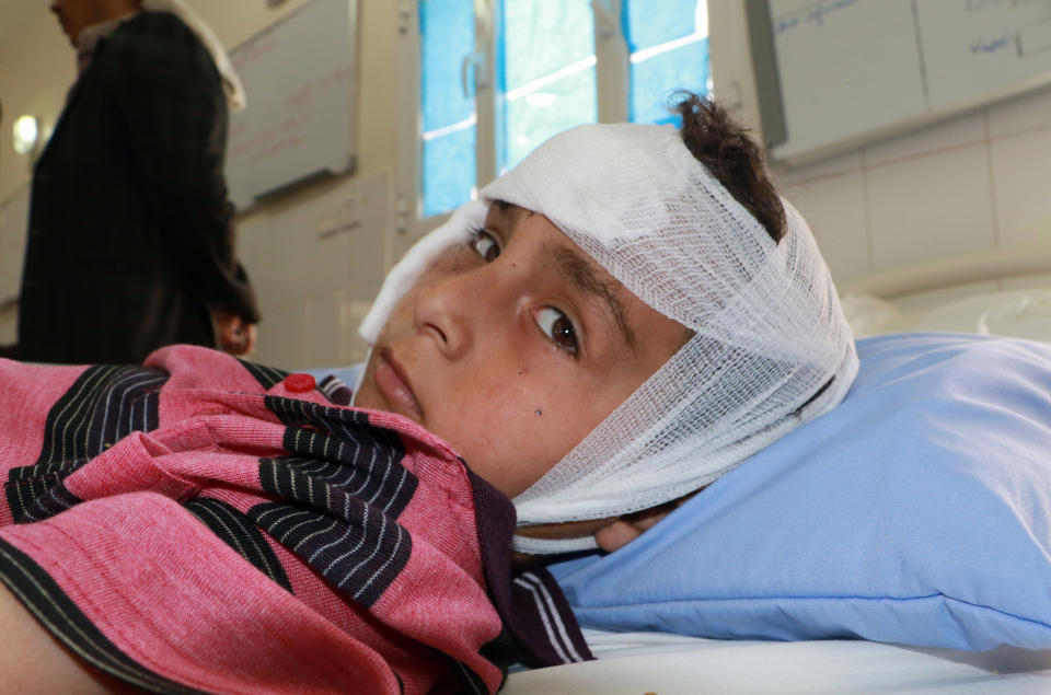 <p>A Yemeni boy wounded in an air strike by coalition forces the previous day on a bus at a market in rebel-held northern Yemen lies on his hospital in the Yemeni city of Saada on Aug. 10, 2018. (Photo: Stringer/AFP/Getty Images) </p>