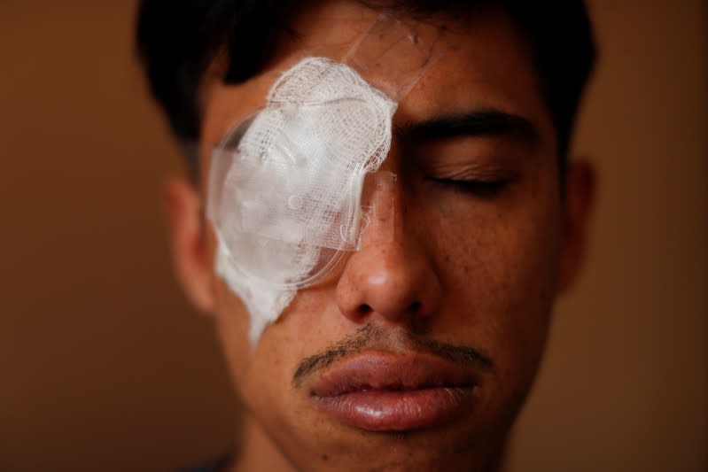 Foto de Jean Espinoza, de 22 años, posando para una fotografía en un hotel en Santiago, Chile