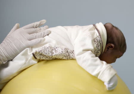 Physiotherapist Jeime Lara Leal exercises 19-day-old Sophia, who is Ianka Mikaelle Barbosa's second child and was born with microcephaly, at Pedro l Hospital in Campina Grande, Brazil February 18, 2016. REUTERS/Ricardo Moraes