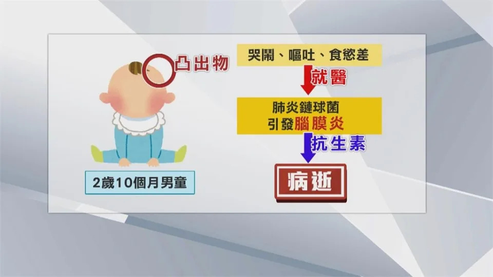 台中2孩童染肺炎鏈球菌「頭頂長角」　經抗生素治療仍搶救不治