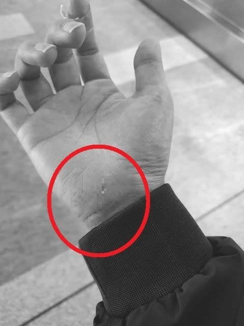 男網友在PTT上發文，表示自己被機捷手扶梯上的針狀物（上）劃破，手掌因此流血。（圖／翻攝自PTT）