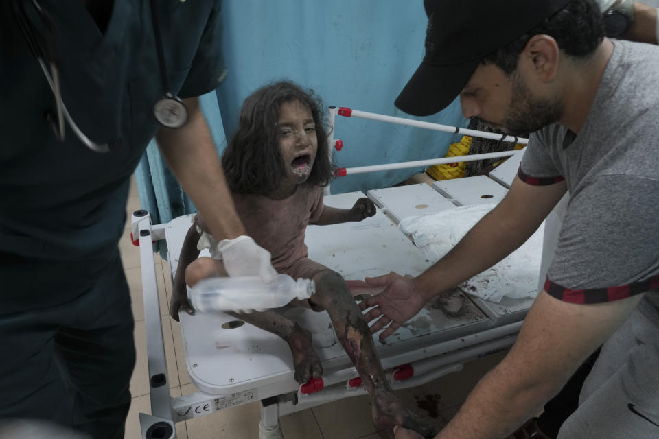 A Palestinian child wounded in an Israeli bombardment is treated in a hospital in Deir al Balah, south of the Gaza Strip, Friday, Oct. 27, 2023. (AP Photo/Hatem Moussa)