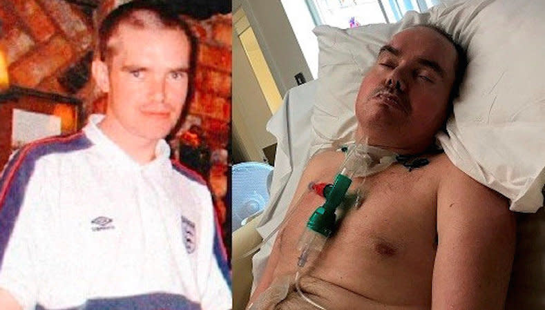 (L-R) Alec Driver before and after the attack. See SWNS story SWLEmurder. A violent thug has been jailed for life for attacking a man after a party so viciously he was left in a vegetative state for 12 years before his death.  Boozed up Mark Cranfield jumped on Alec Driver's head with both feet after knocking him to the floor and booting him in the face after a house party in February 2007. Tragically, Mr Driver was left in a vegetive state until his death in April 2019 aged 41. Cranfield, now 38, was jailed at Preston Crown Court on Friday after pleading guilty to murder. He had previously been spent 14 years in jail for attempted murder. 