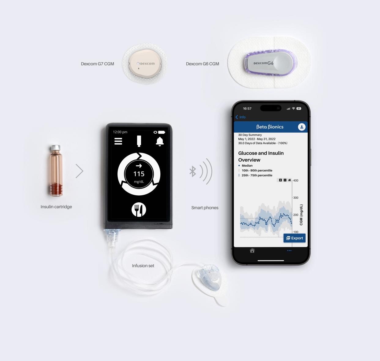 A product photo from Beta Bionics of the iLet Bionic Pancreas pump, with the Dexcom G7 continuous glucose monitor that Trevor Hack, 12, is using.