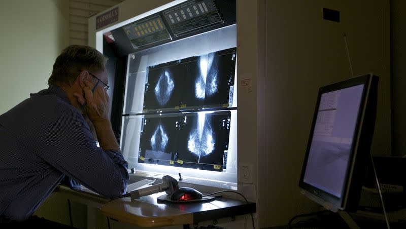 In this photo taken on Thursday, May. 6, 2010, Dr. Gerald Iba, a radiologist, checks mammograms at the Elizabeth Center for Cancer Detection in Los Angeles. The FDA released new guidelines for breast cancer screening.