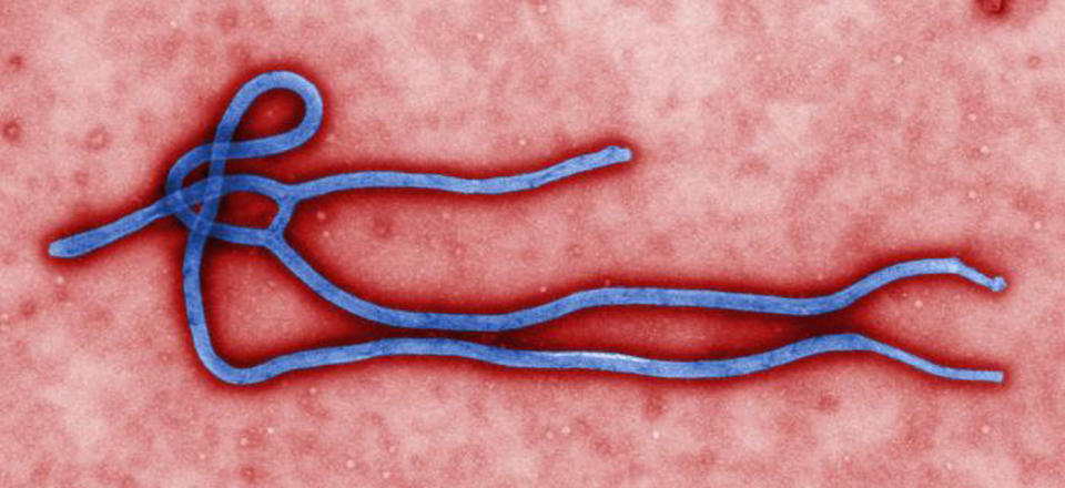 FILE - This undated file image made available by the CDC shows the Ebola Virus. Hospitals around the country are already getting ample opportunities to test their infection control procedures due to a growing number of Ebola Virus infection false alarms. Across the U.S., one of the nation&#39;s largest ambulance companies has put together step-by-step instructions on how to wrap the interior of a rig with plastic sheeting while transporting a patient infected with Ebola. (AP Photo/CDC, File)