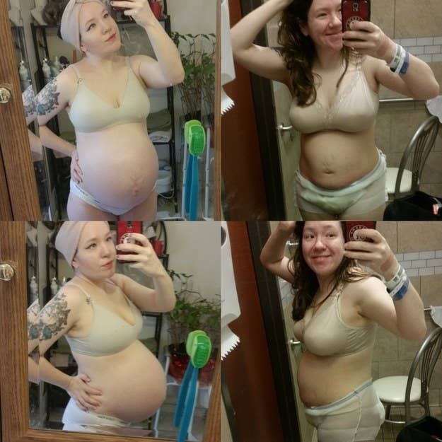 21 Awesome Photos That Show How Different Postpartum Bodies Can Look