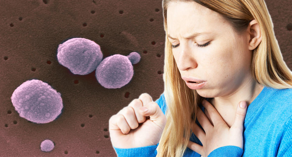 Strep A infections can be dangerous and potentially life-threatening. [Photo: Getty]