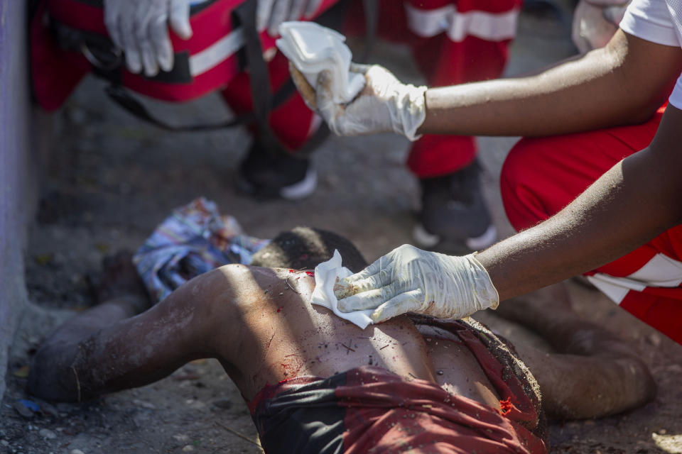 A wounded inmate is tended to after an attempted escape from the Croix-des-Bouquets Civil Prison in Port-au-Prince, Haiti, Thursday, Feb. 25, 2021. At least seven people were killed and one injured on Thursday after eyewitnesses told The Associated Press that several inmates tried to escape from a prison in Haiti’s capital. (AP Photo/Dieu Nalio Chery).