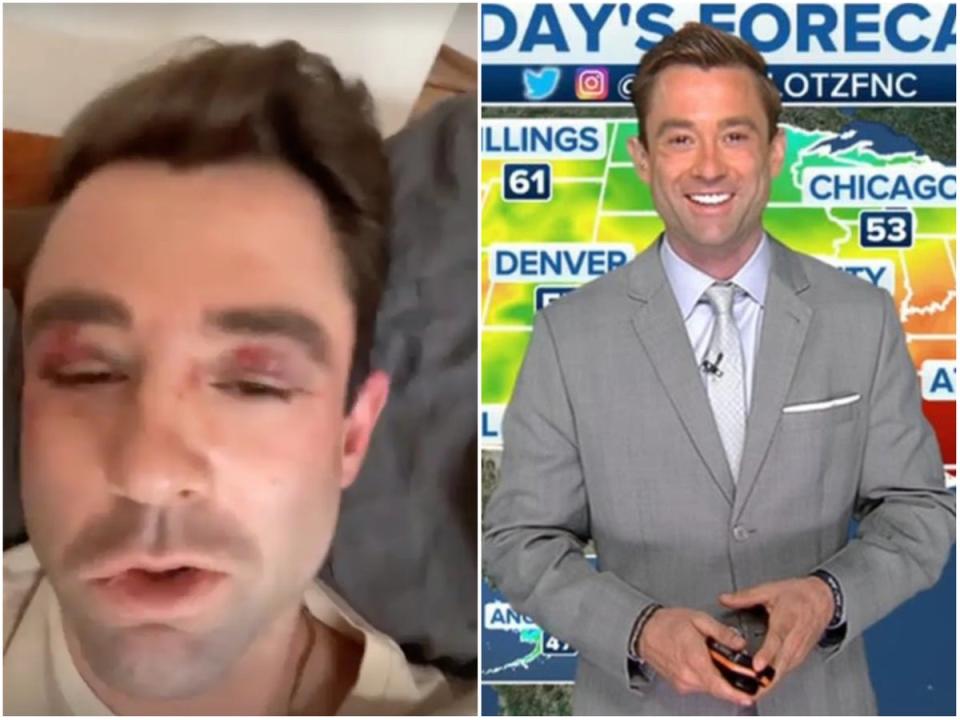 Fox News weatherman Adam Klotz, 37, said he was assaulted by a group of teenagers on the New York Subway (Screenshot / Adam Klotz / Instagram / Fox News)