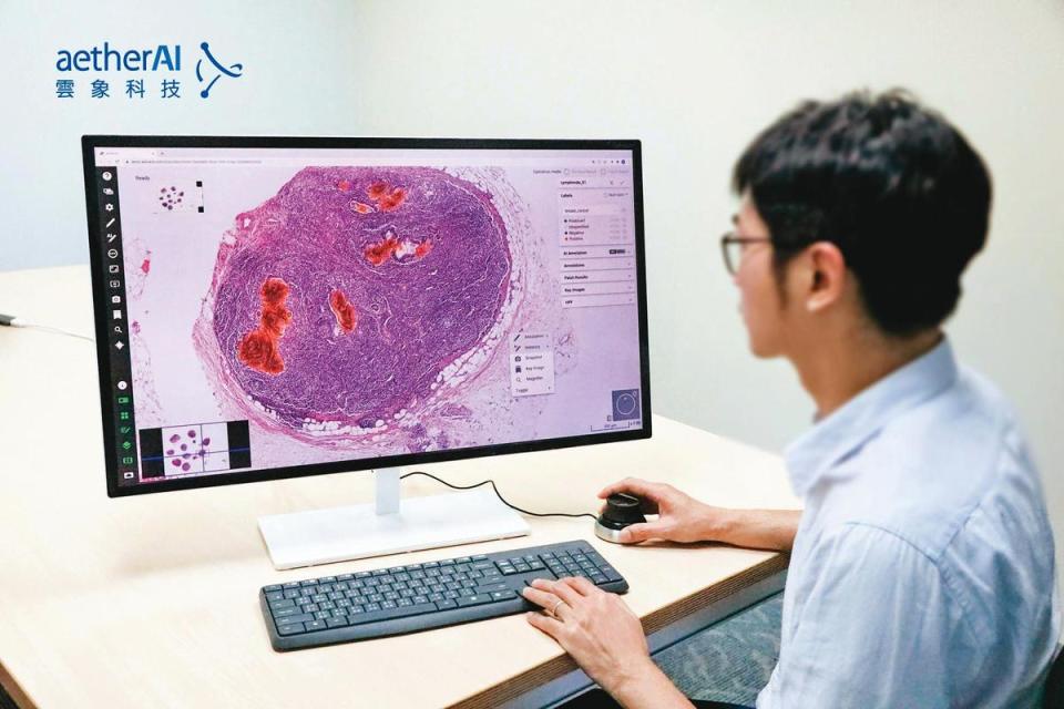 人工智慧在醫療上的應用大多從影像先開始，因為原本用人來看的東西，用AI來看，可能看得更快更準。（雲象科技提供）