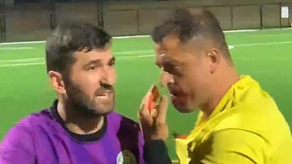 A soccer referee has broken his jaw in a vicious assault at a Sydney match on Friday night., , The official was charged at by a man dressed in black, believed to be a suspended player, who forced him to the ground, then repeatedly punched and kicked him as players and spectators tried to stop the attack. Picture: Supplied