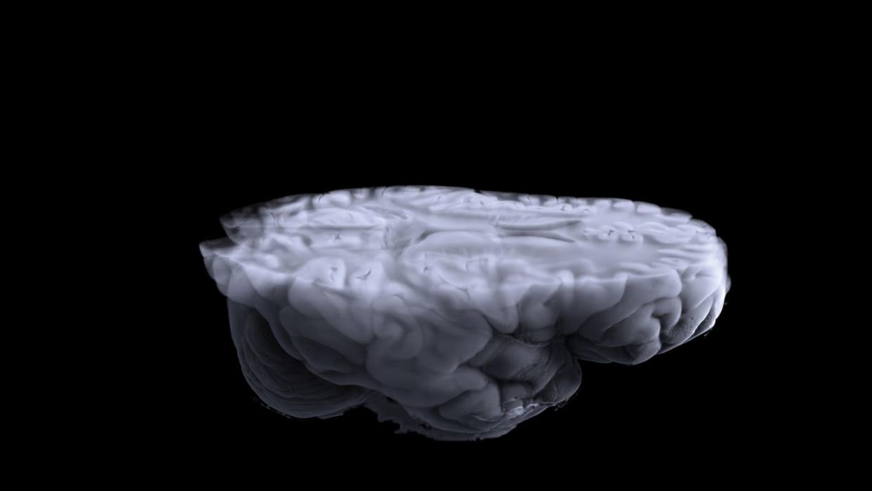 Human Brains Have Gotten Astonishingly Larger Over the Final 75 Years