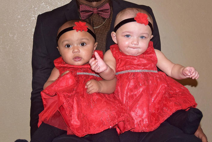 Mother Of Rare Biracial Twins Born In Illinois Speaks Out ‘we Don T See Color