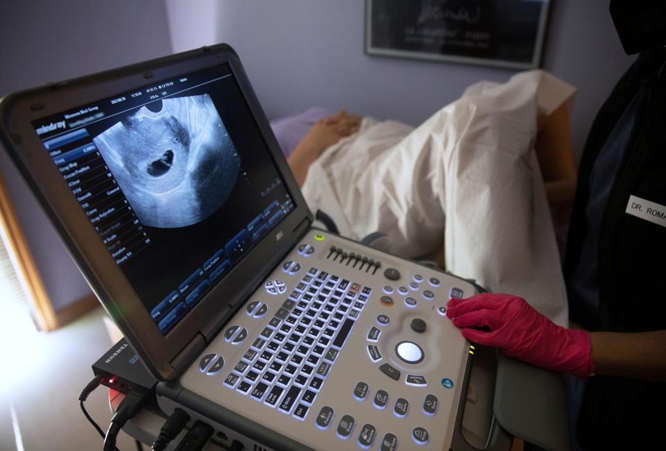 Dr. Catherine Romanos, with the Women's Med Center in Kettering, near Dayton, Ohio, performs a sonogram on a woman from Kentucky, Thursday, June 30, 2022. When Roe vs. Wade was overturned a week ago by the Supreme Court, Kentucky shut down all abortions because of trigger laws. Romanos identified the amniotic sac and said the pregnancy wasn't viable. At a little over six weeks, there was no heart beat.