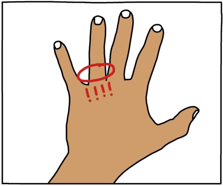 illustration of hand with missing wedding ring