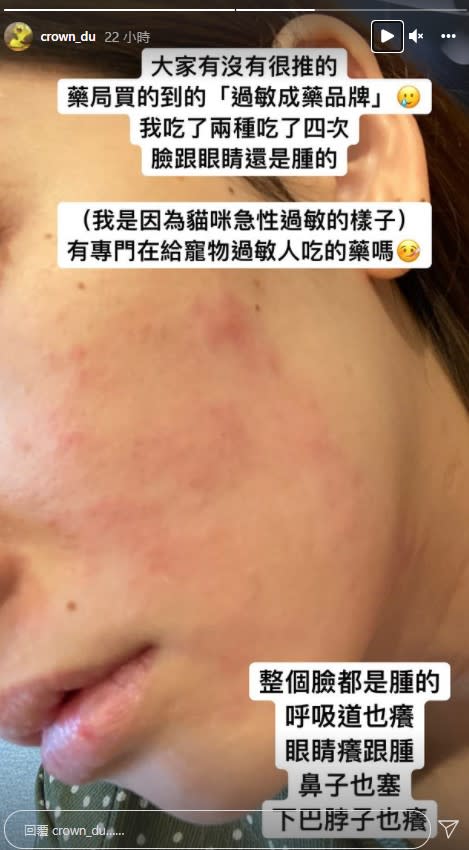 滴妹自曝因為貓咪急性過敏，和粉絲求救是否有推薦的成藥品牌。（圖／翻攝自IG@crown_du）