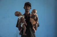 Tigrayan refugee Abraha Kinfe Gebremariam, 40, holds his 4-month-old twin daughters Aden, left, and Turfu, inside their family's shelter in Hamdayet, eastern Sudan, near the border with Ethiopia, on March 23, 2021. Abraha searches their faces for traces of their mother. Babies change, especially this young, he says. But for now, his family agrees, one of the girls does look like Letay. (AP Photo/Nariman El-Mofty)