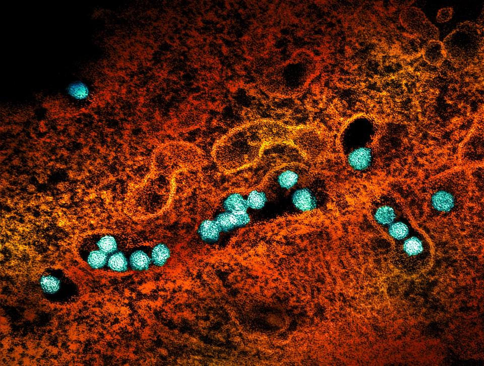 Microscopic view of West Nile virus particles in a cell. (NIAID), <a href="http://creativecommons.org/licenses/by/4.0/" rel="nofollow noopener" target="_blank" data-ylk="slk:CC BY;elm:context_link;itc:0;sec:content-canvas" class="link ">CC BY</a>