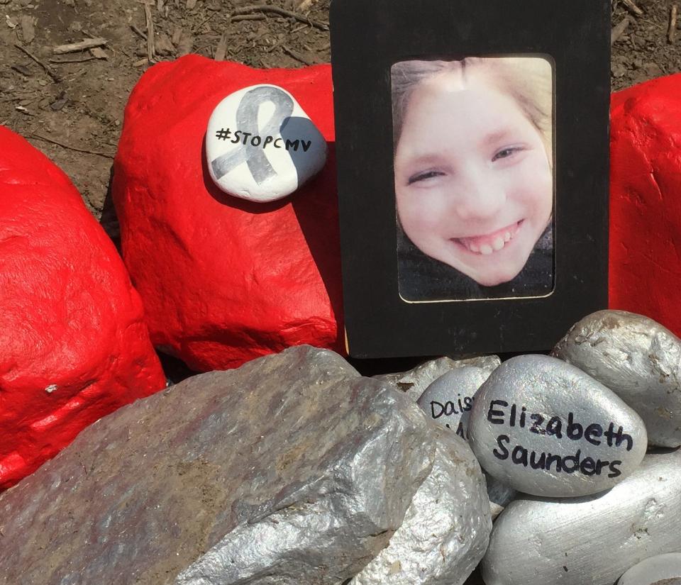 Elizabeth Saunders died at 16 years old from a seizure after she contracted congenital cytomegalovirus, or CMV, as a newborn, leading to severe health issues throughout her life. Her mother, Lisa Saunders, has advocated to prevent more health issues from CMV after her daughter's death.