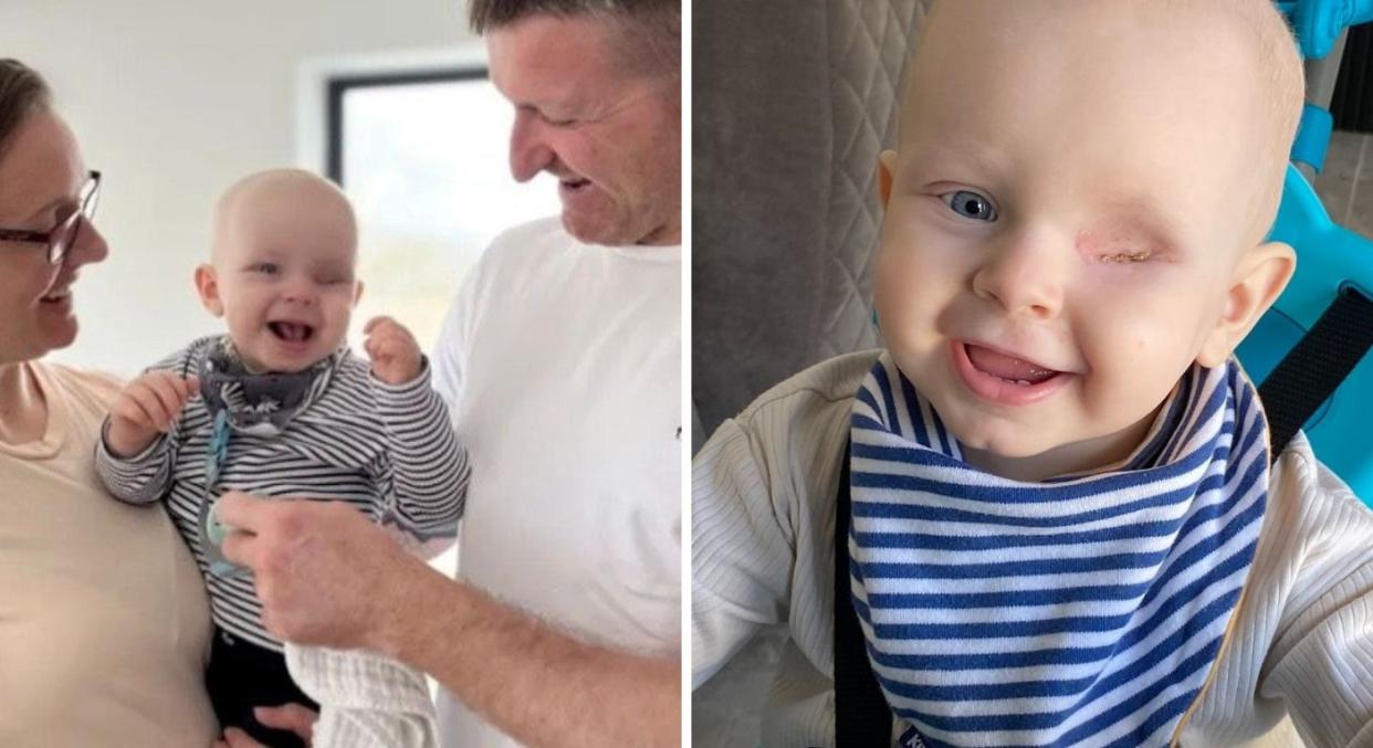 Becky Flower and Damien Stephens thought their baby had a lazy eye, but were shocked to discover it was actually a sign of rare cancer. (Becky Flower/SWNS)
