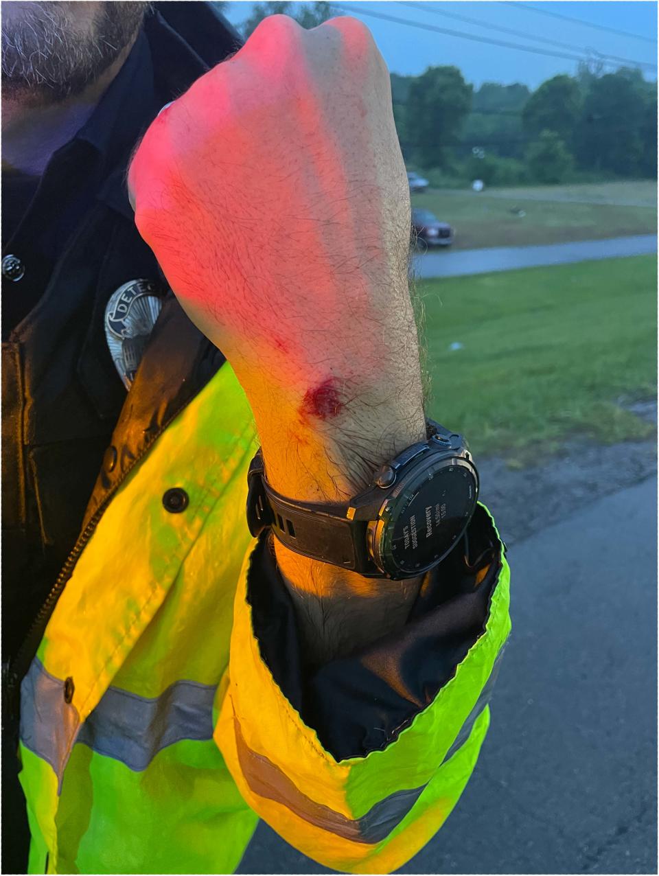 An image from Louisville Metro Police Department shows an injury to the wrist of Detective Bryan Gillis following an incident with Scottie Scheffler prior to the second round of the PGA Championship at Valhalla Golf Club in Louisville, May 17, 2024. This image was included in an LPMD report on the arrest of Scheffler released June 7, 2024.