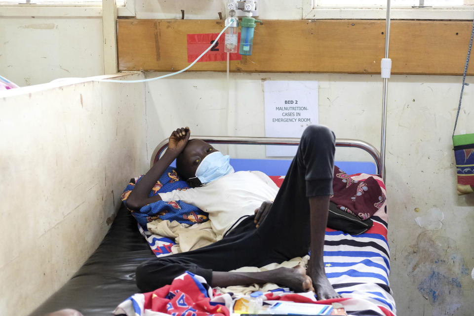23 years old John Elugalt, a sickler resting on a hospital bed inside the emergency room, at the Mbale Regional Referral Hospital in Mbale, Uganda, Wednesday, April 24, 2024. (AP Photo/Hajarah Nalwadda)