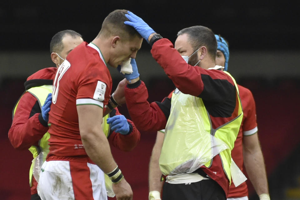 FILE - Wales George North receives treatment during the Six Nations rugby union international between Wales and Ireland at the Principality Stadium in Cardiff, Wales, on Feb. 7, 2021. The Rugby World Cup will take place to the backdrop of a concussion lawsuit that has similarities to one settled by the NFL in 2013 at a likely cost of more than $1 billion. (AP Photo/Rui Vieira, File)