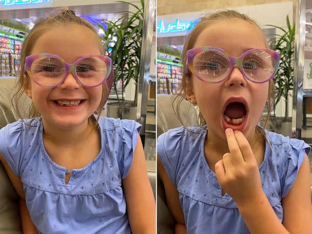 PHOTO: Lena said she has lost several teeth already, including on past trips to Tennessee and St. Croix, but this is her first time losing a tooth in the sky. (Courtesy Lauren Larmon)