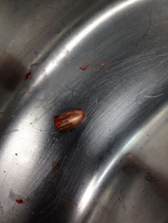 A bullet claimed to be taken out of a 6-month-old's brain is seen in Chicago, Illinois, U.S., in this picture uploaded to social media on November 12, 2018. Mahua Dey/via
