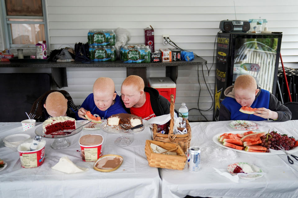 <p>Baraka Lusambo, 7, Mwigulu Magesaa 14, Emmanuel Rutema, 15, and Pendo Noni 16, Tanzanians with albinism who had body parts chopped off in witchcraft-driven attacks, eat dinner at a home in the Staten Island borough of New York City, June 4, 2017. (Photo: Carlo Allegri/Reuters) </p>