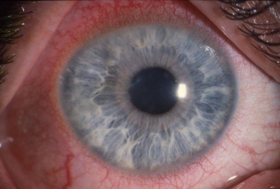 The warning comes after a study in the British Journal of Ophthalmology