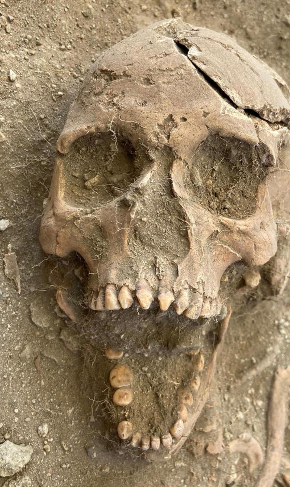 In this photo provided by St. Eustatius Center for Archaeological Research, SECAR, the skull of what is believed to be an enslaved man sits in the ground at an excavation in the former Golden Rock plantation west of the international Airport in Oranjestad, on the Dutch Caribbean island of St. Eustatius, on the Leeward Islands, Thursday, May 27, 2021. According to specialists, the filed teeth are an indication that this man belonged to the first generation of slaves from Africa, because filing teeth was forbidden by slave owners. (SECAR via AP)