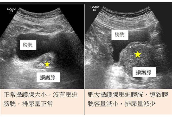 （圖片提供／振興醫院）