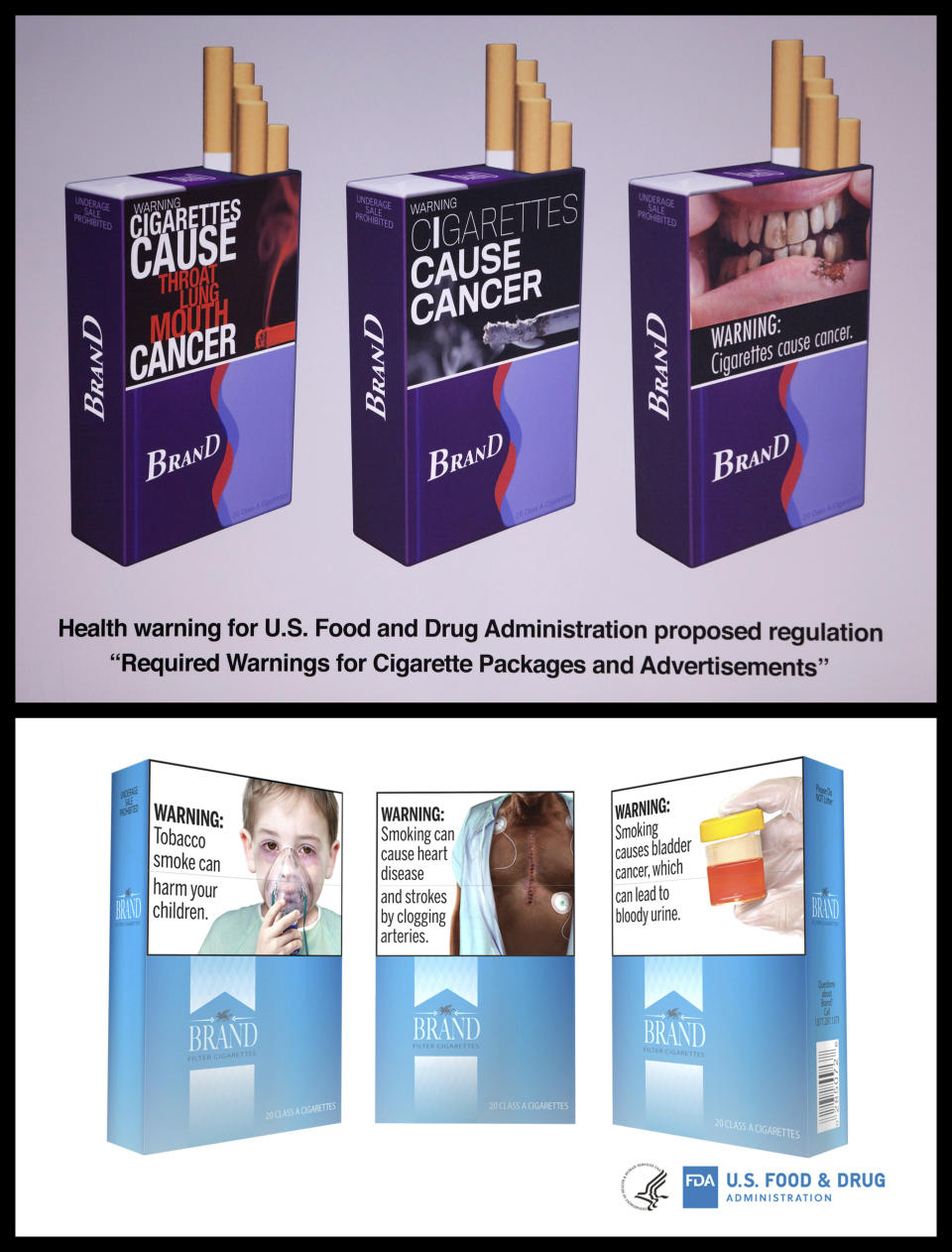 This combination of images released by the FDA shows proposed warning labels for cigarette packaging from 2010, top, and 2019. In August 2019, the Food and Drug Administration proposed new graphic warning labels for cigarettes packets, a court-ordered move triggered by a lawsuit from the American Cancer Society and other groups who alleged the agency was dragging its feet on the effort. A 2011 attempt at requiring labels was defeated in court by tobacco companies. (FDA via AP)
