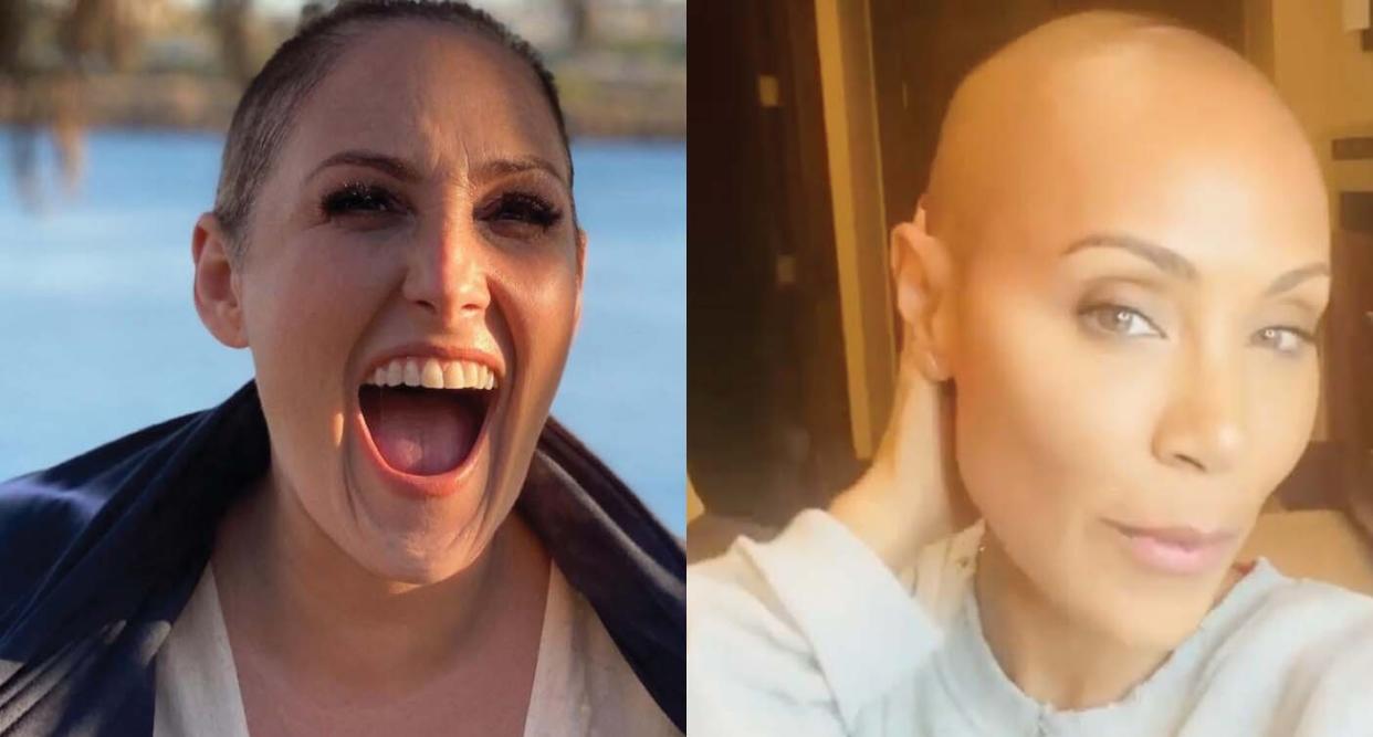 Ricki Lake, left, and Jada Pinkett Smith, have gotten candid about their struggles with hair loss, helping other women feel less alone. (Photos: Instagram)