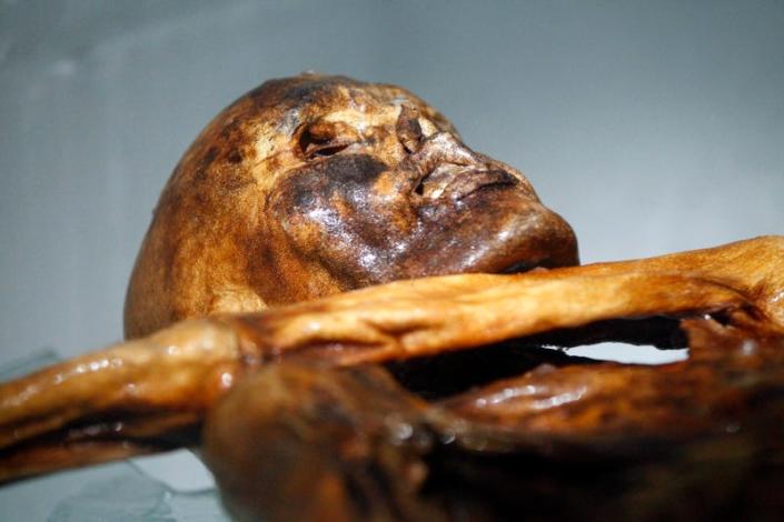 Ötzi, une momie de 5 300 ans.