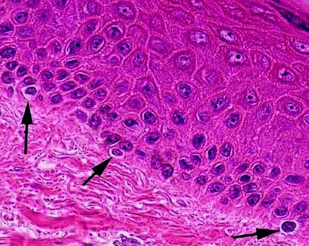 Micrographie de mélanocytes dans l’épiderme