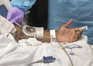 A nurse injects steroids into COVID-19 patient Cedric Daniels, 37, of Gonzales, La., as he recuperates at Our Lady of the Lake Regional Medical Center in Baton Rouge, Monday, Aug. 2, 2021. Louisiana is leading the nation in the number of new COVID cases per capita and remains one of the bottom five states in administering vaccinations. (AP Photo/Ted Jackson)