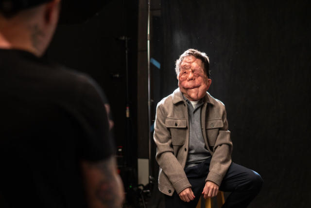 A Different Man Star Adam Pearson Opened Up About The Lazy Way