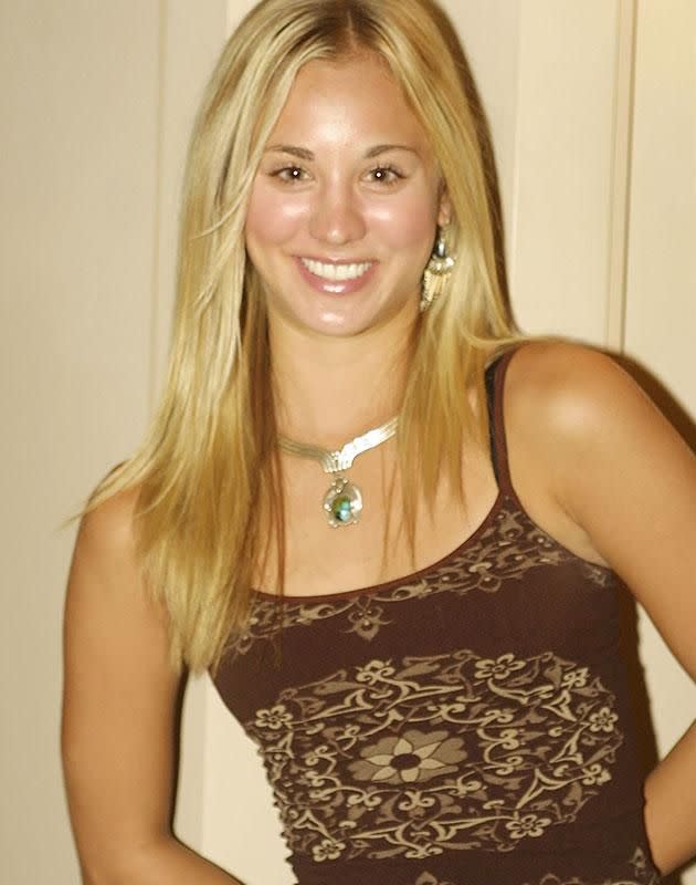 Kaley before her surgery. Source: Getty