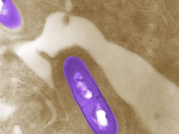 An electron micrograph of a Listeria bacterium in tissue is seen in a 2002 image from the Centers for Disease Control and Prevention (CDC).  REUTERS/Elizabeth White/CDC/Handout via Reuters  