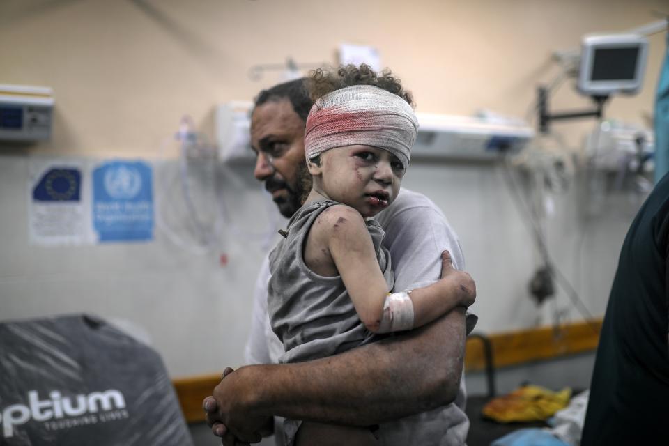 An injured child is brought to the Nassr hospital after the Israeli airstrikes in Khan Younis, southern Gaza (Anadolu via Getty Images)